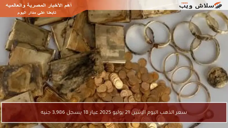 سعر الذهب اليوم الإثنين 21 يوليو 2025 عيار 18 يسجل 3,986 جنيه