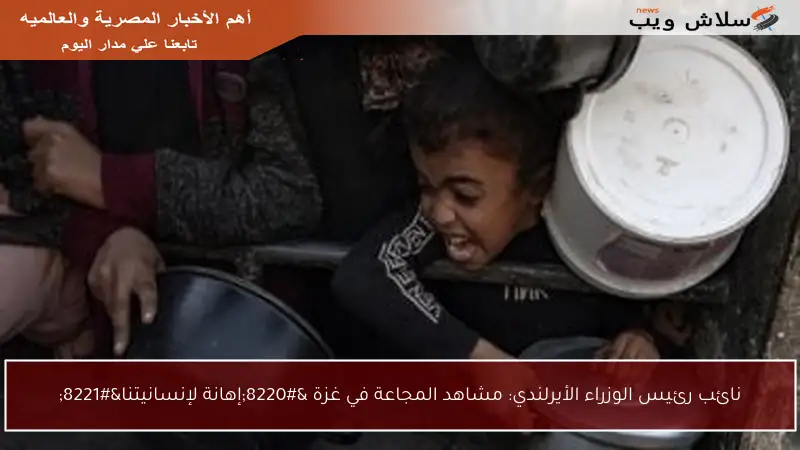 نائب رئيس الوزراء الأيرلندي: مشاهد المجاعة في غزة “إهانة لإنسانيتنا”