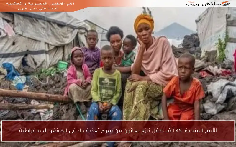 الأمم المتحدة: 45 ألف طفل نازح يعانون من سوء تغذية حاد في الكونغو الديمقراطية