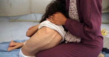 مجمع الشفاء الطبي: انتشار فيروس بين سكان غزة ولا إمكانية لمعرفة سببه