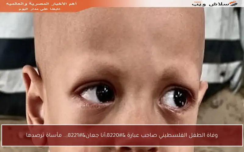 وفاة الطفل الفلسطيني صاحب عبارة “أنا جعان”.. مأساة ترصدها